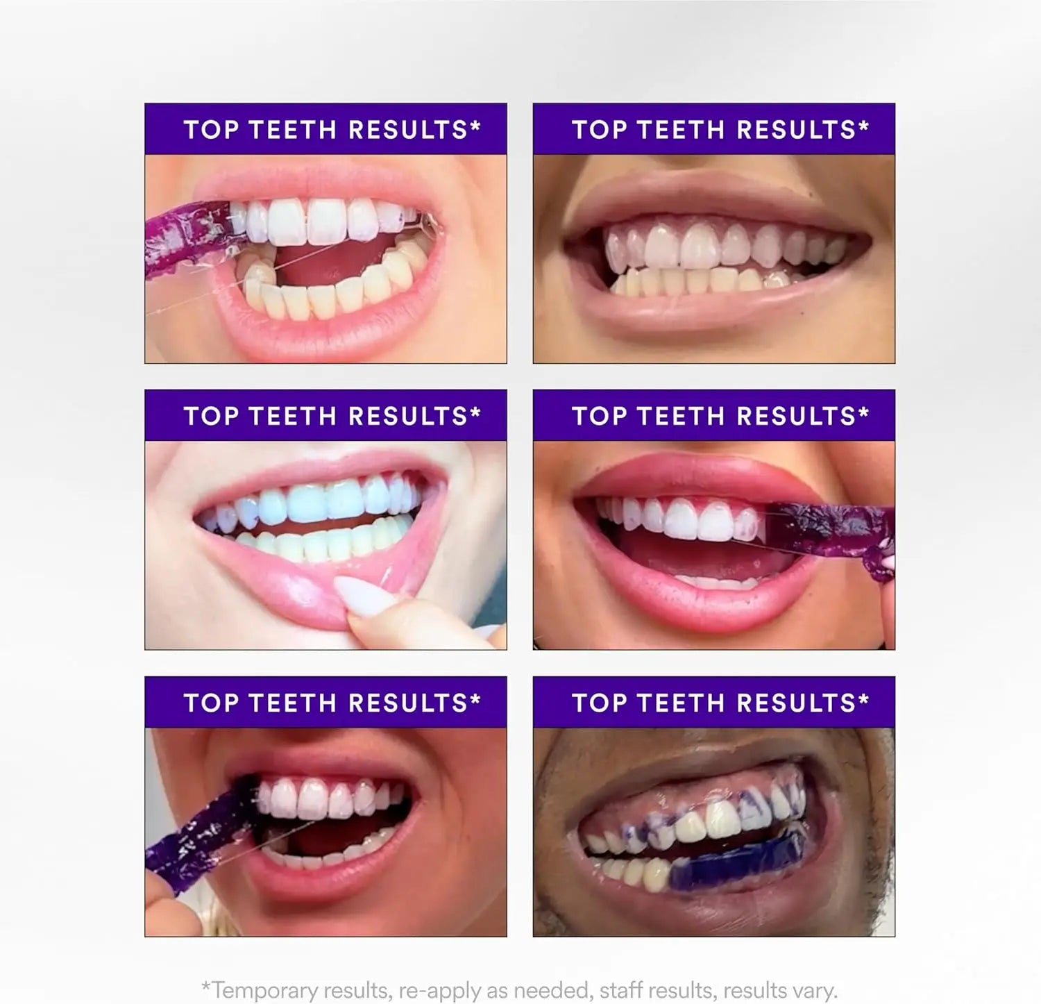 Hismile V34 Whitening Strips, Teeth Whitening Strips, Purple Tooth Whitening, Purple V34 Whitening Strips, Tooth Stain Treatment